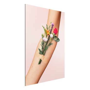 Print on aluminium - Arm With Flowers